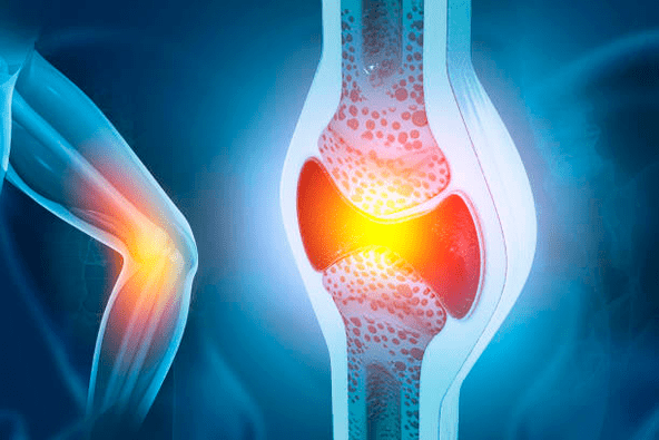 Prévention des maladies articulaires.