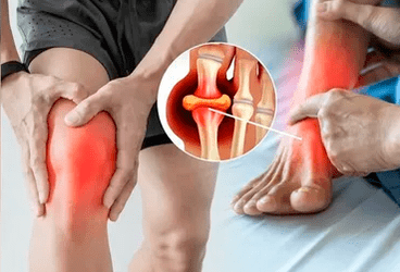 Schéma d'application du gel Icexin sur la zone articulaire du genou et du pied.